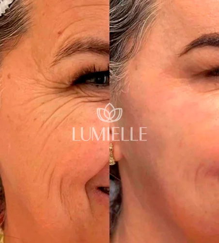 LUMIELLE-PRV-2.webp